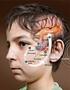 Auditive Verarbeitungs- und Wahrnehmungsstörung im Kindesalter