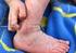 Behandlung von Hautläsionen an den Beinen bei chron. venöser Insuffizienz und anderen Ursachen