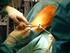 Endoskopische Therapieverfahren in der Bariatrie