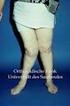 Kniegelenk. D. Kohn. Klinische und kernspintomographische Bilder: 11. Relief des gesunden und des geschädigten Kniegelenks von vorne