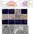 HIGH-RESOLUTION ANALYSIS OF THE MURINE MHC CLASS II IMMUNOPEPTIDOME AND APPLICATIONS IN DIFFERENT DISEASE SETTINGS