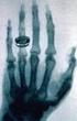 Röntgenaufnahme der Hand seiner Frau; Ganzkörperröntgenbild eines Menschen