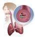 Bronchospastik COPD & Asthma