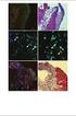 Effekte des Angiogenesefaktors VEGF (Vascular Endothelial Growth Factor) an Glioma- und Mikrogliazellen