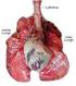 Die menschliche Lunge