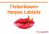 Fieberblasen Herpes Labialis