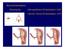 Myomembolisation Uterusarterien-Embolisation UAE Uterine Fibroid Embolization UFE