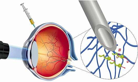 Sie injizieren kleine Nanoroboter in das Auge, um damit Wirkstoffe gezielt in dichtes Gewebe zu applizieren. Solchen minimal-invasiven Prozessen gehört die Zukunft.