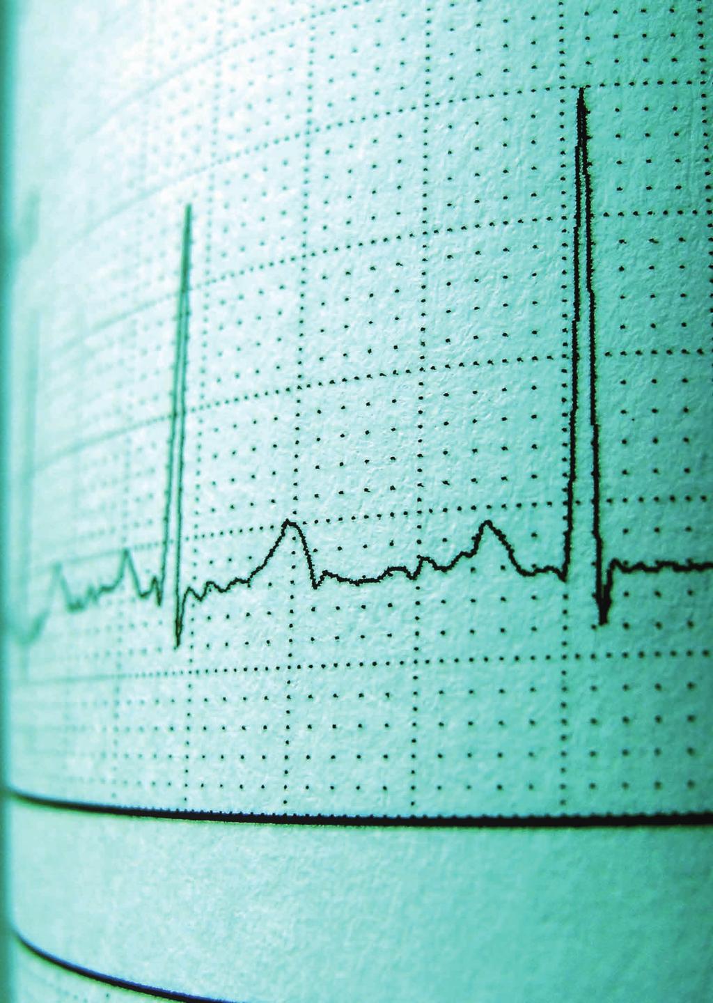 Leitinien Meldungen aus der DGK In aller Kürze Meldungen aus der DGK sich die Deutsche Gesellschaft für Kardiologie entschieden, Qualitätskriterien für eine Zertifizierung von Zentren für die