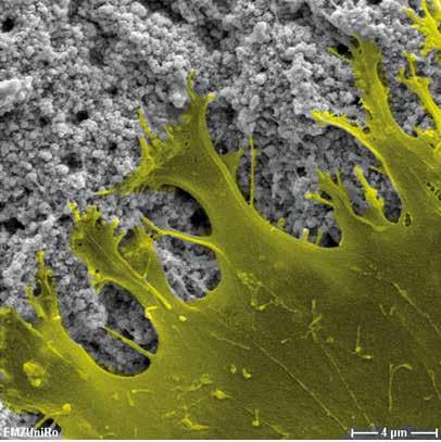 2015 Jan;26(1):5350. 4 µm Bildquelle: Prof. Dr. Barbara Nebe, Rostock Implantatoberfläche in Bestform!
