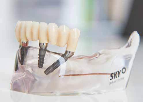 Menschen, die noch ihre eigenen Zähne besitzen, jedoch große Probleme damit haben, machen sich ebenso Sorgen, wie diejenigen, die bereits eine Zahnprothese tragen.