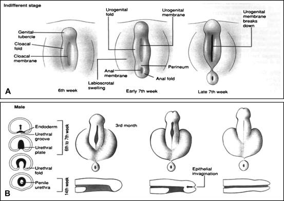 Hypospadie Definition/Embryologie Hypospadie = inkomplette Virilisierung der Genitalhöcker mit nachfolgender ungenügender Entwicklung des ventralen Penisgewebes Embryologie: - Entwicklung des