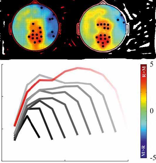 ...DEPARTMENT BEHAVIORAL NEUROLOGY Where do neuronal event cascades evolve? The figure shows the spatial occurrence of these cascades.