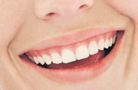 Laszlo Konrad: Vollkeramische Zahnimplantate Für gesundes und strahlendes Lächeln Metallfreie Zirkonoxidimplantate für jede Indikation Bei einem anziehenden Lächeln sind nicht nur gerade weiße Zähne