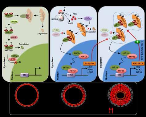 Forschungshighlight 2019 RASSF1A-HIF1α-Schleife stimuliert Warburg-Effekt bei Krebs und pulmonaler Hypertonie Der Hypoxie-Signalweg spielt eine wesentliche Rolle bei gut- und bösartigen