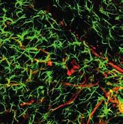 Membrane Permeabilization in Intestinal Epithelial Cells Trigger Adaptive Immunity During Tumorigenesis mit dem Förderpreis des Biologischen Vereins 2018