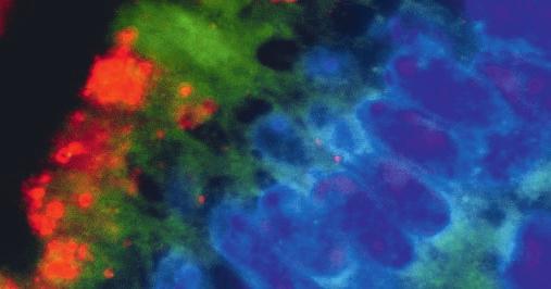 Cell Plasticity Florian Greten II Ausgewählte Publikationen Greten, FR, Grivennikov, SI Inflammation and Cancer: Triggers, Mechanisms and Consequences. Immunity.