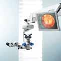 IOLMaster Gerät zur exakten, berührungsfreien und effizienten Vermessung des Auges sowie Berechnung der Intraokularlinse vor einer
