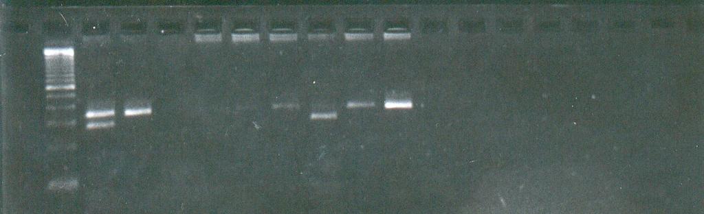 Material und Methoden 34 2.9.1 DNA-Amplifikation 100 ng genomische DNA wurden als Template für die PCR eingesetzt.