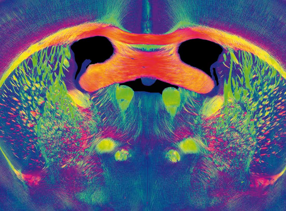 Nervenfasern des Gehirns in 70 Mikrometer dünnen, histologischen Frontalschnitten, sichtbar