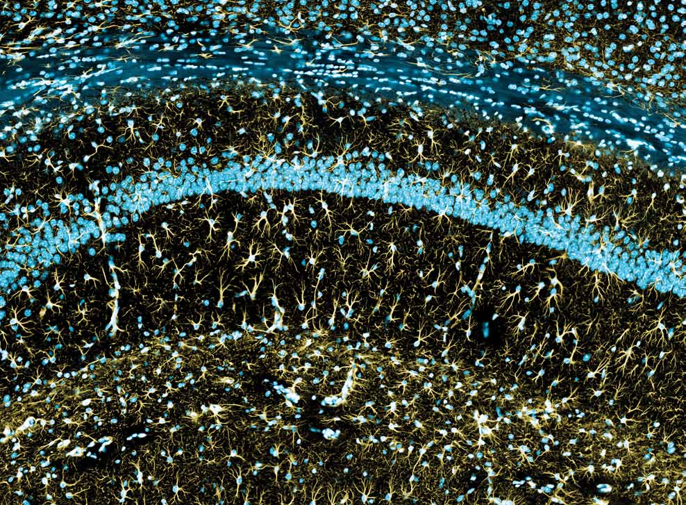 Teilbereich von Hippocampus und Neocortex mit fluoreszierenden Zellkernen (blau) und