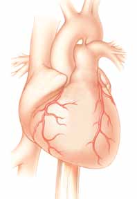 Ihr Herz Koronare Herzkrankheiten Genau wie Wasserleitungen können auch Ihre Koronararterien verstopfen.