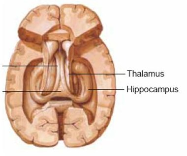 Zum limbischen System gehören u.a. Hippocampus und Amygdala (Mandelkern). Es spielt die entscheidende Rolle bei der Übertragung von Informationen ins Langzeitgedächtnis.