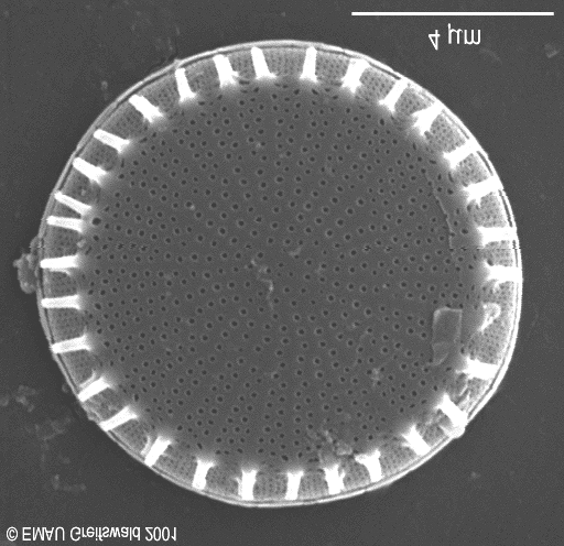 Abbildung 31: SEM-Aufnahme einer Stephanodiscus hantzschii aus dem Plankton von Aurith (05/2000).