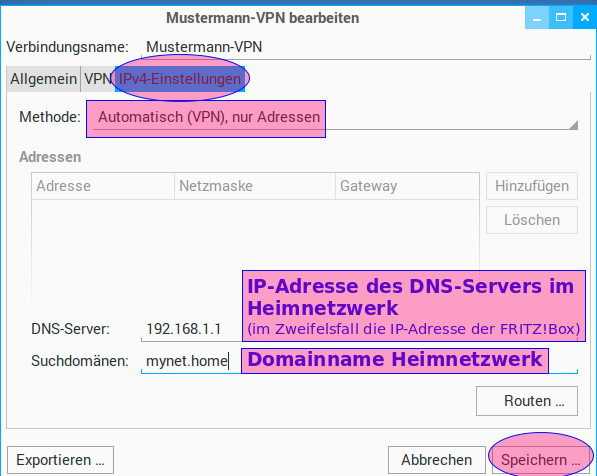 Schritt 6 DNS-Server des Heimnetzwerkes konfigurieren Damit der VPN-Client neben öffentlichen Domainnamen (z. B. google.de) auch Webservices im Heimnetzwerk (z.b. baikal.mynet.