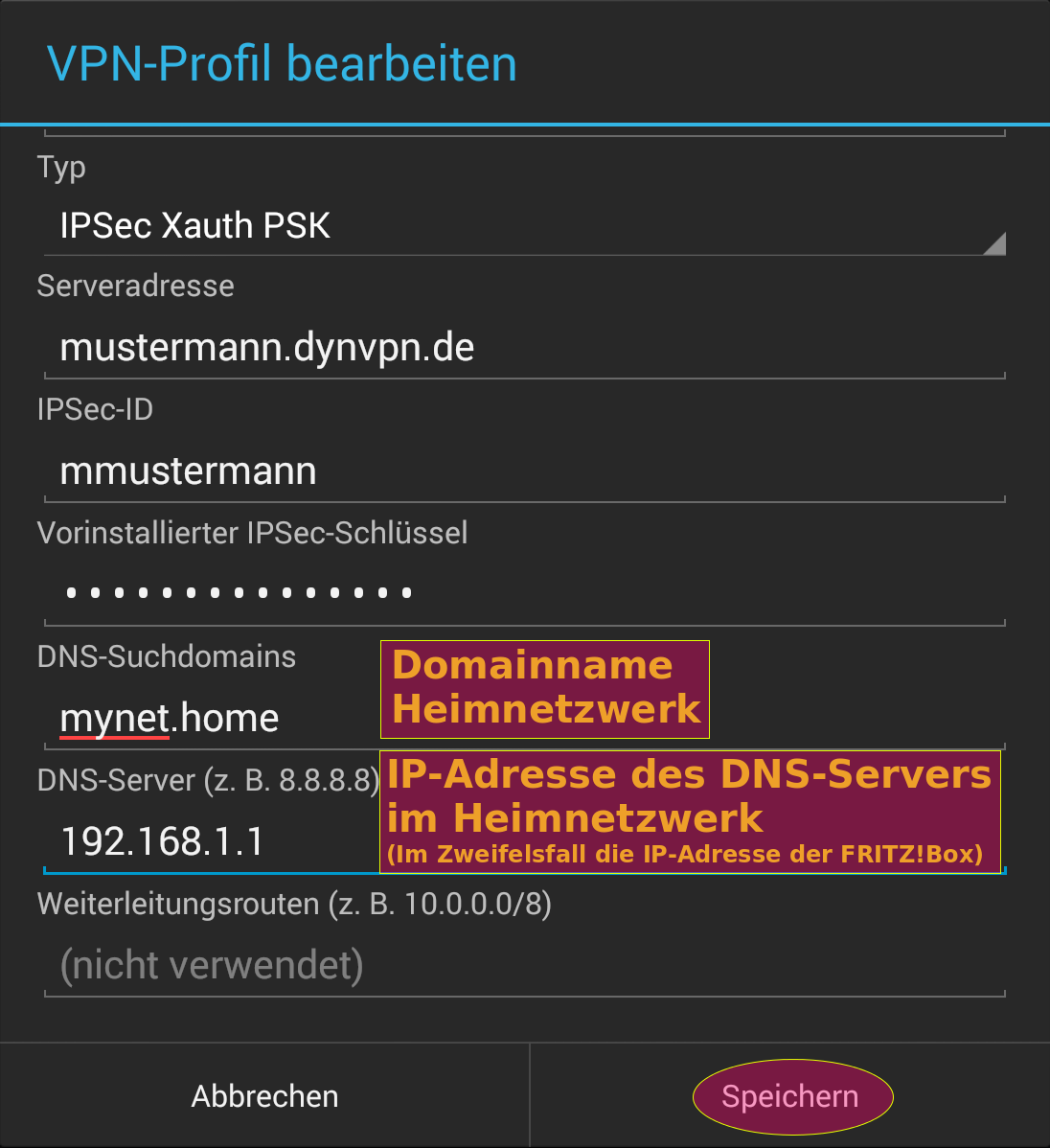 DNS-Server des Heimnetzwerkes konfigurieren Damit der VPN-Client neben öffentlichen Domainnamen (z. B. google.de) auch Webservices im Heimnetzwerk (z.b. baikal.mynet.