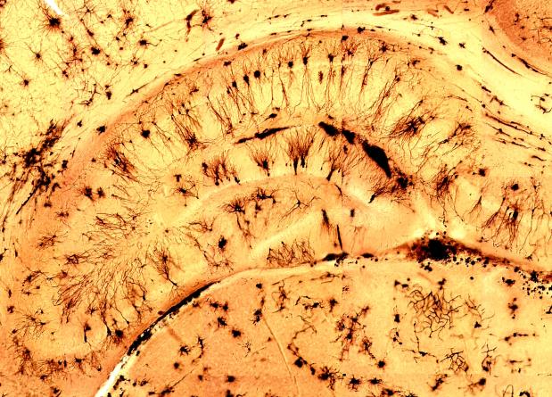 Nervenzellen im Hippocampus werden bei männlichen und weiblichen Ratten in unterschiedlicher Weise durch pränatalen Stress beeinflusst