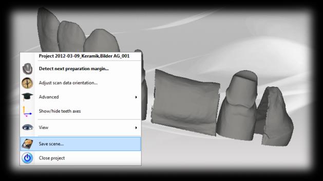 Neue Funktionalitäten der KaVo multicad 1. 3D Konstruktionen in PDF 2. Geänderte Indikation Veneer 3. Verbessertes Messwerkzeug 4. Generelle Verbesserungen 5. Beschneiden 6.