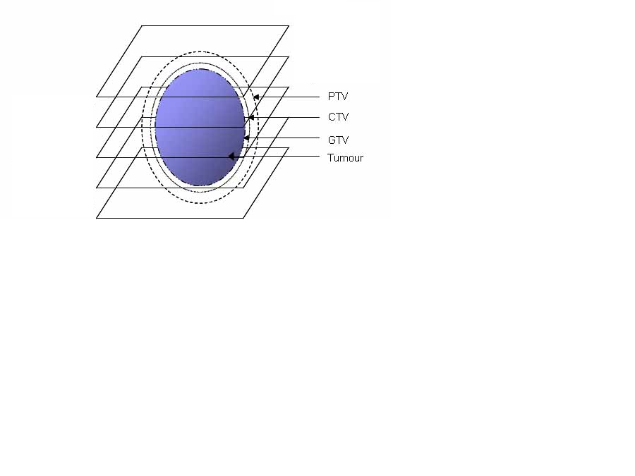 Abbildung 4.2: Schematische Darstellung der relevanten Zielvolumina.
