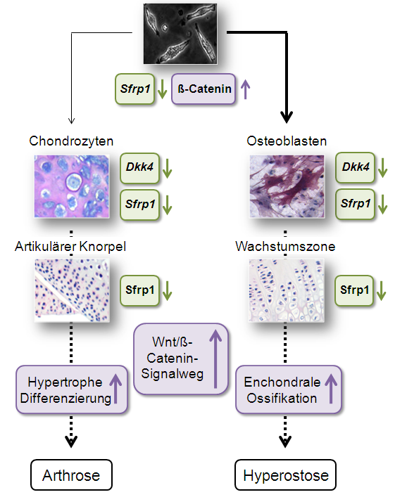 4 DISKUSSION 85 Abb. 28: Der Wnt/ß-Catenin-Signalweg ist beim STR/ort-Mausstamm im Knorpel und Knochen verstärkt aktiviert und trägt so zur Entstehung der Arthrose und der Hyperostose bei.