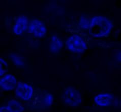 Immunfluoreszenzfärbung (siehe 3.9.3 Immunfluoreszenzfärbung) und konfokaler Mikroskopie untersucht. DAPI HMGB1 Proteinase 3 Overlay neg. Kontrolle Abb.