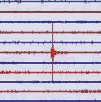 Zu einer Erklärung der Live-Seismogramme gelangt man über den Reiter Beispiel, wo folgendes zu finden ist: Mit einem Seismometer erstellte Abbildung des zeitabhängigen Verlaufs der Bodenbewegung an