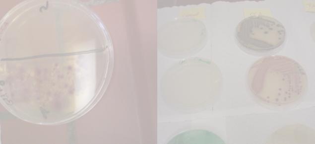 Infektiologie - Kurs Färbetechniken Kultivierung auf Nährböden