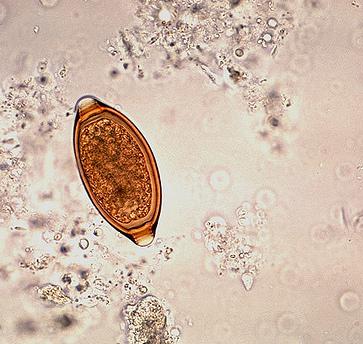 Protozoen Entamoeba histolytica Giardia lamblia Leishmania MIKROSKOPIE Diagnose wird durch einen Einachweis im Stuhl gestellt Unverwechselbare Morphologie der Eier: zitronenförmige Gestalt