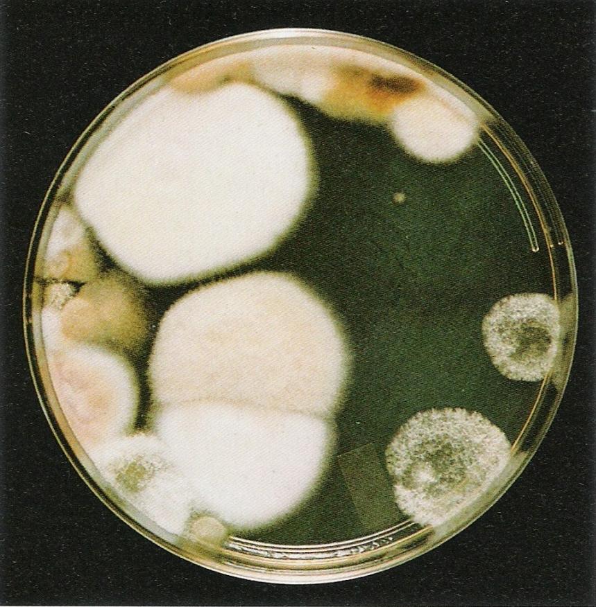 Mikrobiologisches Praktikum - Kultivierung von Pilzen Temperaturansprüche Aerobes/Anaerobes Wachstum Plattenausstrich feste Nährböden: Sabouraud-Dextrose- Agar (SDA) Nutrient-Agar Blut-Agar
