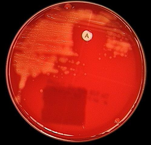 Mikrobiologisches Praktikum - Wirksamkeit antimikrobieller Substanzen Kirby-Bauer- Methode Epsilometer-Test Optochin-Test Novobiocin-Test Bacitracin-Test: mit dem