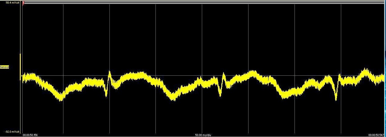 Bild 4. Signalverlauf eines Absolutsensors am Quer- und Längsfehler Das Amplitudenverhältnis von Quer- zu Längsfehler beträgt etwa 3,5 : 1 (ca. 11 db).