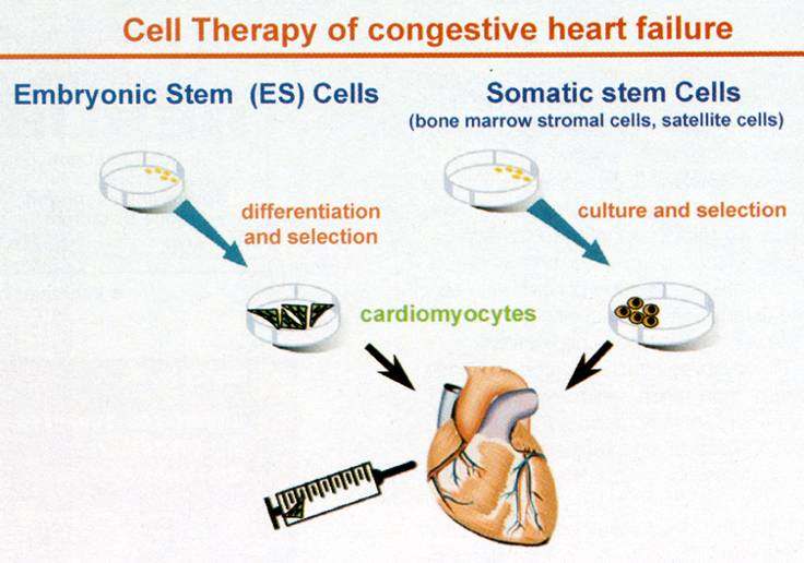 Einsatz von Stammzellen zur Generierung von regenerativen Zellen und