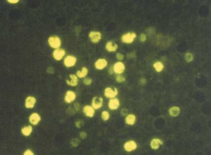 Vielfalt der Parasiten = Vielfalt der Laboratoriumsdiagnostik 5 Parasitologische Untersuchungen Mikroskopische