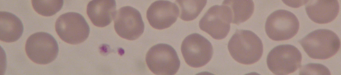 Typische Lymphozyten Leicht aktivierte Lymphozyten Größe: 10 15 µm Kern: rund - oval leicht