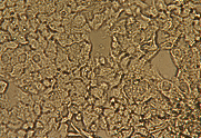 Material und Methoden Zelllinie Caco-2-Zellen stellen eine permanente humane Zelllinie dar, welche ihren Ursprung in einem Adenokarzinom des Kolons eines 72-jährigen kaukasischen Mannes hat.