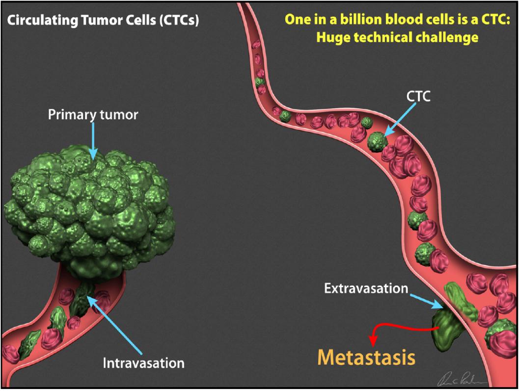 Zirkulierende Tumorzellen