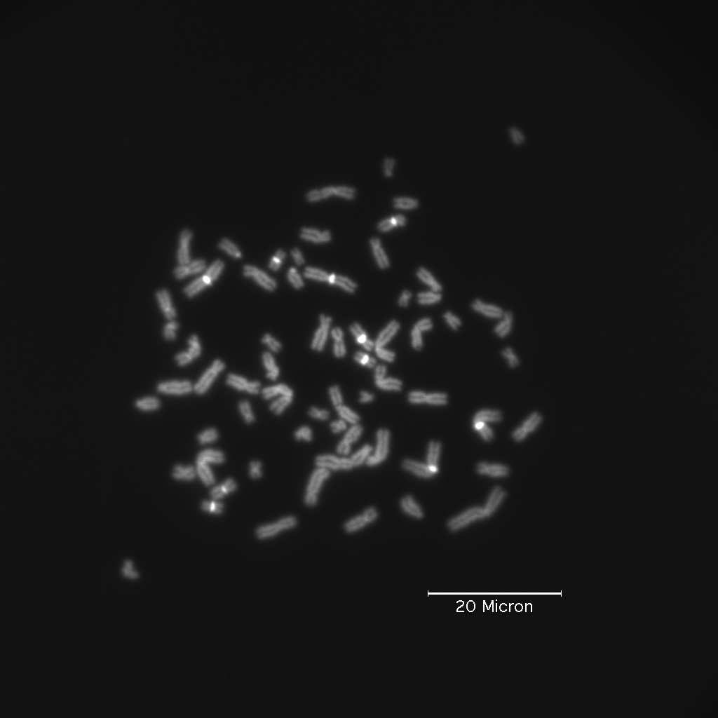 Fig. 3. (A) DAPI-Färbung vom Methaphasechromosomen. Die Färbung der Chromosomen ist deutlich und gleichmässig. (B) DAPI/Distamycin A-Färbung von kondensierten Chromosomen.
