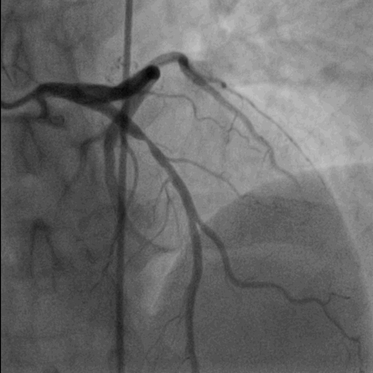 Kardiologie-Workshop für