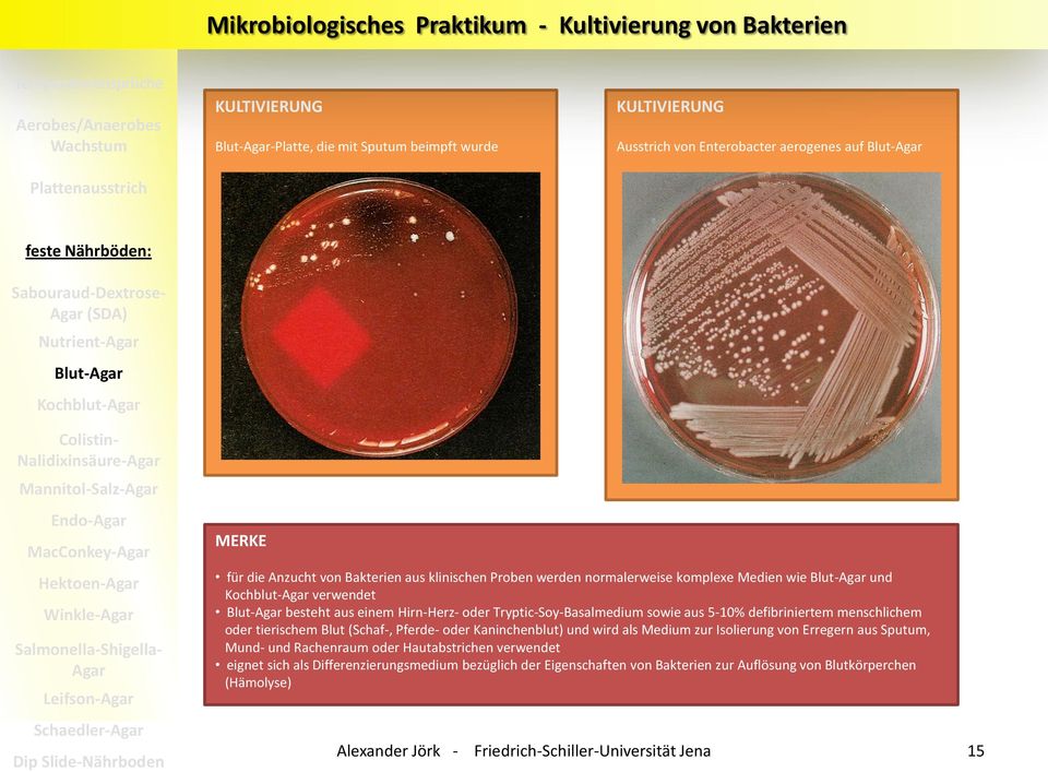 Winkle-Agar Salmonella-Shigella- Agar Leifson-Agar Schaedler-Agar Dip Slide-Nährboden MERKE für die Anzucht von Bakterien aus klinischen Proben werden normalerweise komplexe Medien wie Blut-Agar und