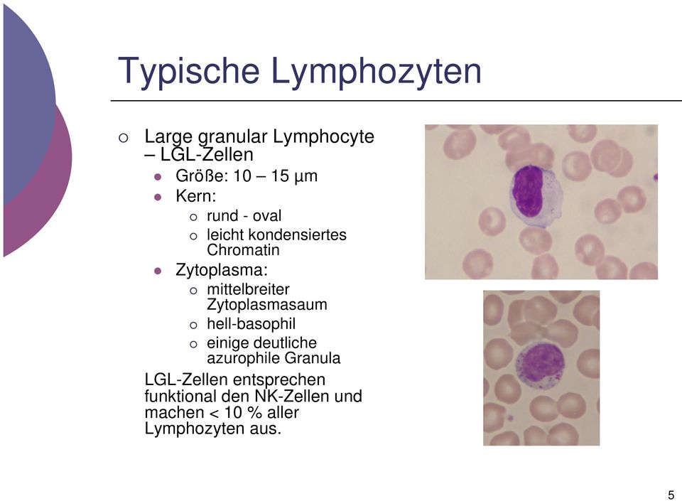 Zytoplasmasaum hell-basophil einige deutliche azurophile Granula LGL-Zellen